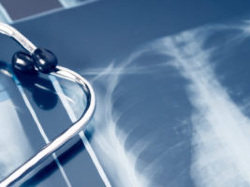 concept lung disease